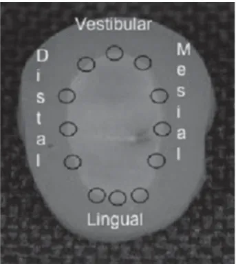 Figure 5- Schematic diagram representing reading location  related to the proximal aspects