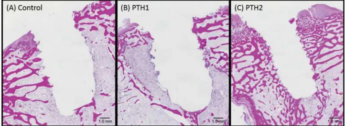 Figure 7- Histological analyses of specimens from the (A) Control as osteoporosis. (B) PTH1: PTH administration for 4 weeks before  implant placement