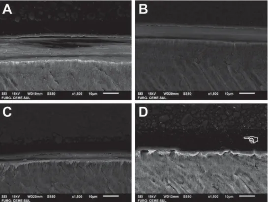 Figure 5- Scanning electron microscopy (SEM) images of dentin bonded interfaces of groups presented in Figure 3 – A: AD5 applied for  V%$'DSSOLHGIRUV&amp;$'DSSOLHGIRUV'FRPPHUFLDOHWFKDQGULQVHDGKHVLYH7KHSRLQWHULQGLFDWHVWKHWKLFNHUDQG more irregular adhesive l