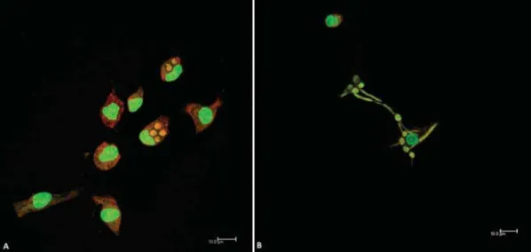 Figure 1- Internalization of dead (A) or viable (B) C. albicans by peritoneal adherent cells (PAC) from aged mice after 30 minutes, in the  proportion 1:1 (CaD1 and CaV1, respectively)