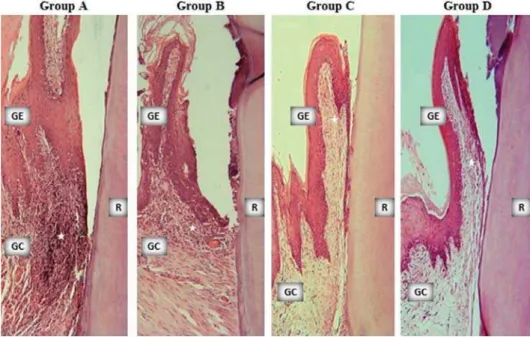 Table 2- HScore values with the inter- and intra-group comparisons of IL-10 staining. Data were expressed as as mean±standart deviation  (GE: Gingival epithelium; GC: Gingival Connective Tissue; PL: Periodontal Ligament)
