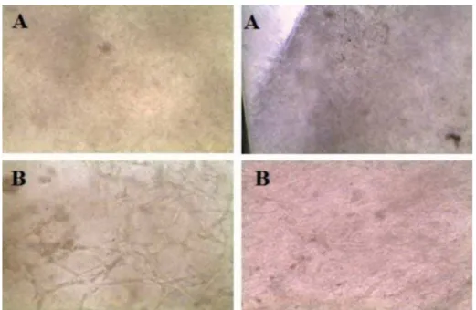 Figure 4- A. Dermal-epidermal substitutes of healthy subjects observed under the inverted microscope (40X)