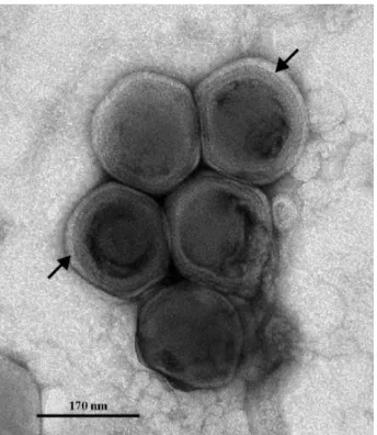 Figura  3:  Micrografia  eletrônica  de  transmissão  de  uma  cultura  de  Emiliania  huxley,  as  setas  indicam o capsideo do vírus Emiliania huxleyi