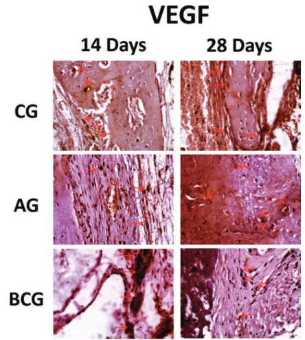 Figure 8-  VEGF immunostaining at 14 days for the experimental groups (CG: moderate; AG: light; BCG: moderate) and at 28 days (CG: 