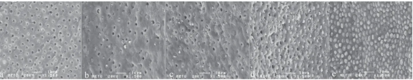 Figure 1-  Scanning electron microscopy (SEM) images showing (a) open dentin tubules after EDTA treatment; (b) partially obturated  dentin tubules in the apical section using AH Plus; (c) partially obturated dentin tubules in the apical region using the En