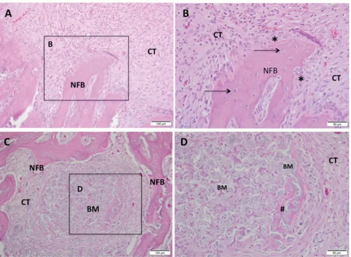 Figure 4-  Representative photomicrographs of alveolar socket after 42 days. A and B: CHA group and C and D: SrCHA group