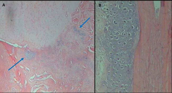 Figura 14. Fotomicrografia de defeito crítico em rádio de coelho aos 15 dias da implantação de  autoenxerto
