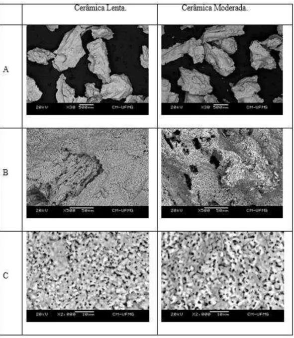 Figura 10. Fotografias da microscopia eletrônica de varredura mostrando os grânulos das biocerâmicas de absorção lenta  e de absorção moderada