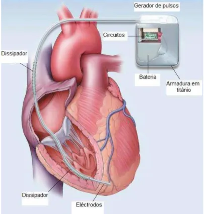 Fig. 2 – Componentes de um CDI. 