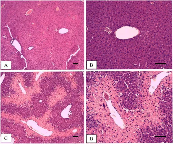 FIGURA 1 -  Tratamento com APAP promove áreas de necrose. Cortes histológicos representativos  do  fígado  de  camundongos  saudáveis  (A  e  B)  e  submetidos  à  sobredose  de  APAP  (C  e  D)