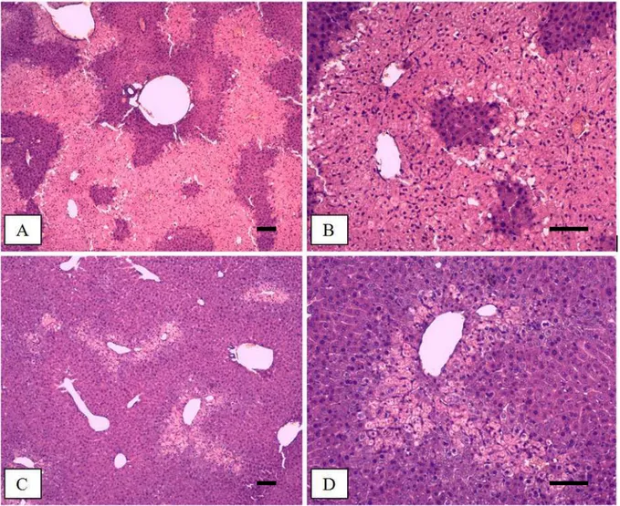 FIGURA 3 -  Tratamento com apirase reduz áreas de necrose. Cortes histológicos representativos do  fígado  de camundongos  submetidos  á sobredose  de APAP  (A  e  B)  e  submetidos  ao tratamento  com  Apyrase (C e D)