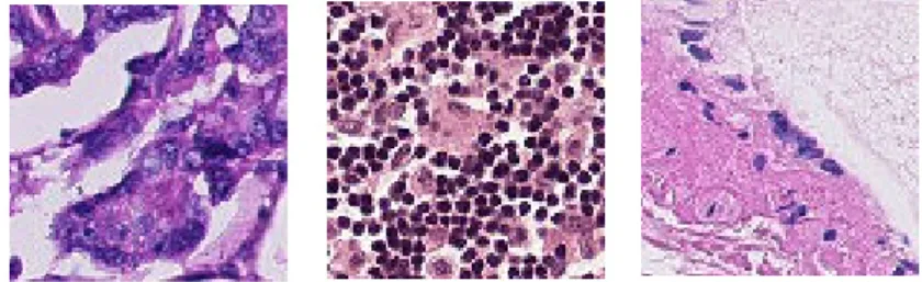 Figure 1. Example of images available in the PatchCamelyon dataset [20]. 
