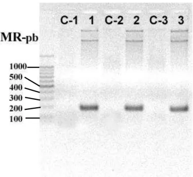 Figura 7: PCR para amplificação das sequências Ts3, Ts1 e TsNTxP 
