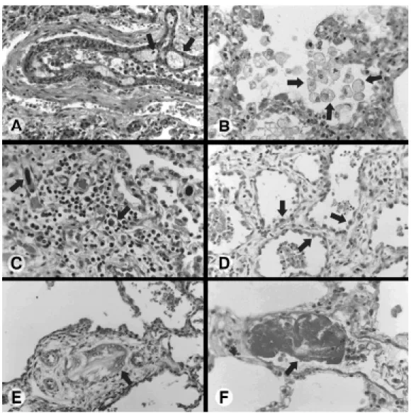 Figure 1 - Some of the most relevant microscopic aspects of the injuries observed