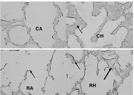 Figure 3 - Elastin fibers at 11 days  modified resorcin-orcein (X 400). Although changes to elastin fiber deposits were not detected, the elastin fibers themselves had a coarser appearance in the hyperoxia and nutritional restriction groups, and in the gr