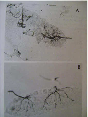 Fig  3.  Foto  de  ovário  dissecado  de  fêmeas  de  culicídeos  em  (A)  ovário  de  fêmea  nulípara  mostrando extremidades traqueolares enoveladas  (B) ovário de fêmea onípara ou párida com  extremidades traqueolares distendidas