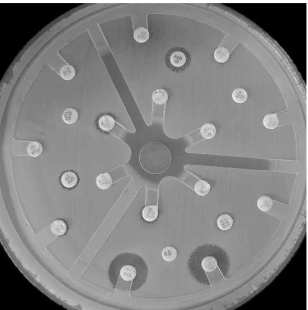 Figura 2  – Teste de disco difusão mostrando cepa de A. baumannii multidroga-resistente