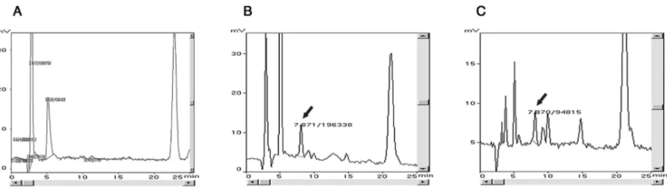 Figure 1 - Chromatograms obtained from plasma: A) blank; B) standard sample containing 25 ng/mL of salbutamol; C) sample of plasma from patient