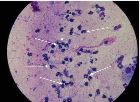 Figura 6. Células arredondadas (polimorfo nucleares) presentes no ejaculado de macho da raça Guzerá na  fase pré-puberal