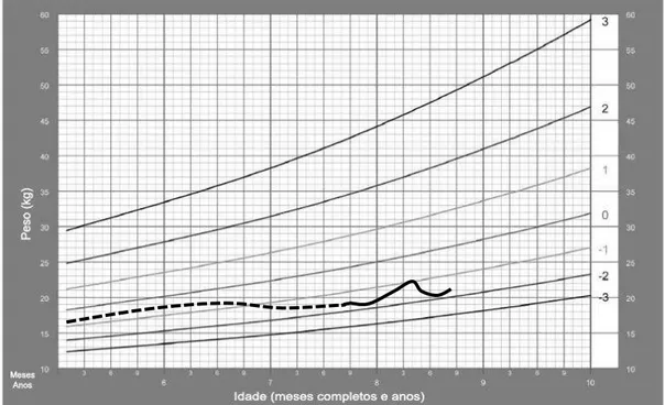 Figura 7: Paciente 2  – Peso/idade: A linha contínua representa as medições realizadas durante o 