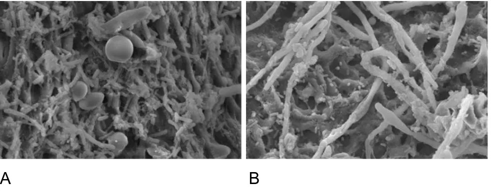 Figura  2.  Microscopia  eletrônica  de grãos  de  Kefir  cultivados  em  água com  açúcar (A)  e 