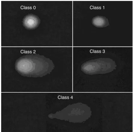 Figure 2 - Photomicrograph of representative sample inducing DNA damage in intensive phototherapy-treated infant.