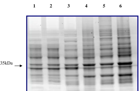 Figura  14.  Avaliação  da  expressão  das  proteínas  recombinantes  rCpsec32  e  rCpsec37  na  linhagem  OverExpress™ C43(DE3) pLysS no tempo de 5h