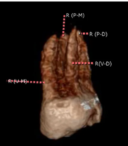 Figura  2. Radiografia  constatando  a  presença  de  quatro  canais  em raízes separadas.