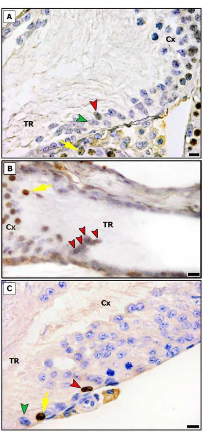 Figura 4 – Imunomarcação para BrdU contemplando a região de transição (TR) e a área adjacente à TR (Cx)  de testículos de ratos Wistar pré-púberes (A-B) e sexualmente maduros (C)
