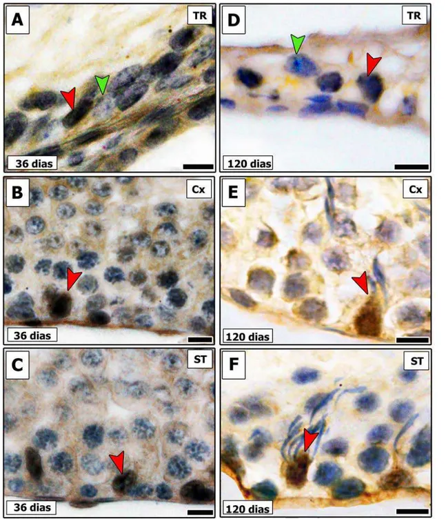 Figura 5 – Imunomarcação para p27 em diferentes áreas testiculares de ratos Wistar pré-púberes (A-C) e  sexualmente maduros (D-F), contemplando a região de transição (TR) (A, D), a área adjacente à região de  transição (B, E) e ao longo dos túbulos seminíf