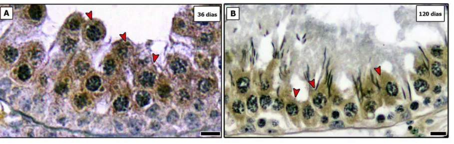 Figura 11 –  Imunomarcação para CCR2, evidenciando o citoplasma e membrana dos espermatócitos  primários (cabeças de setas vermelhas) expressando  esse receptor ao longo dos túbulos seminíferos e região adjacente à região de transição -  tanto em ratos pré