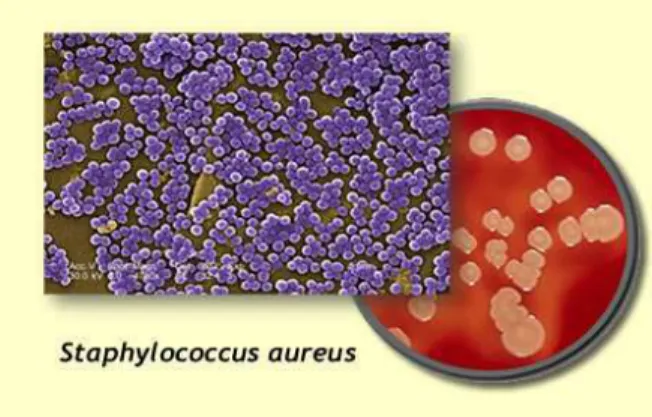 Figura  1–  Staphylococcus  aureus  em  microscopia  (cachos)  e  seu  aspecto  na  placa  de  ágar  sangue 