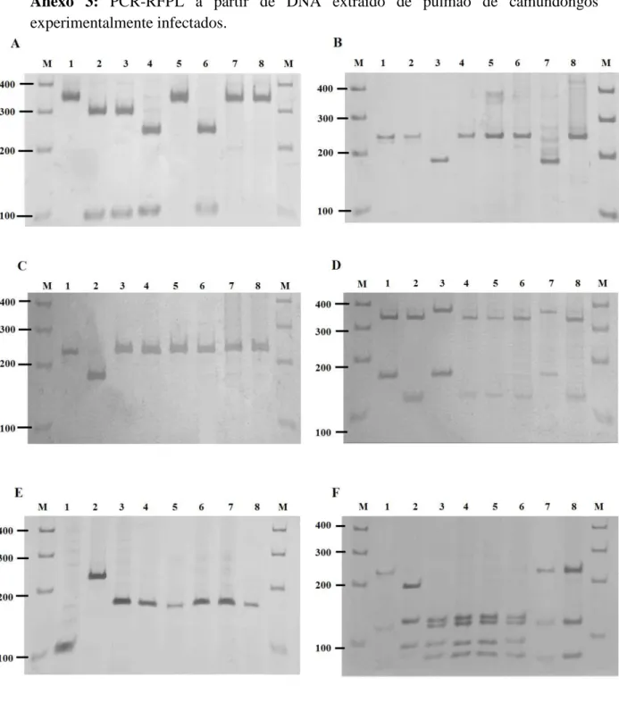 Figura 1. PCR-RFLP em gel de poliacrilamida a 5% corado com nitrato de prata, para a  genotipagem  de  T