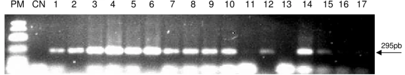 Figura 3 - Eletroforese em gel de agarose 1,2% apresentando resultado da pesquisa do gene  da β-actina nas 17 amostras provenientes de cultivo celular