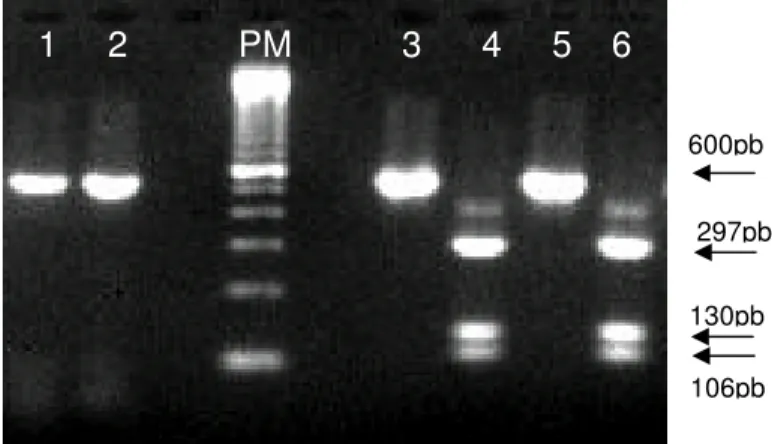 Figura 5 - Análise de perfil de restrição enzimática. Canaletas ímpares e pares: amostra e amostra  clivada com XhoI, respectivamente