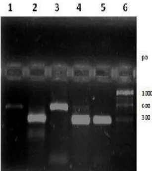 Figura 1. Eletroforese dos produtos da PCR IGRS para  diferenciação  de  bactérias  do  gênero  Mycoplasma:  canaleta  1=amostra  de  campo  BRA/MG562P0511  de  MG  (645  pb);  canaleta  2=amostra  de  campo  BRA/MG770R0512  de  MIN  (308  pb);  canaleta  