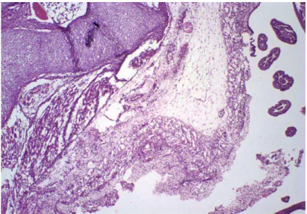 Figura 6. Histopatologia (HE) de Pulmão (400x)  –Infiltrado inflamatório multifocal