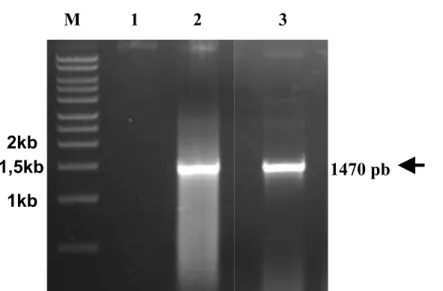 Figura  8. Amplificação  por  PCR  da  região  codificadora  de  FLAGRasGEF1b,  (seta)  utilizando  como  molde o vetor pFLAGCMV2RasGEF1b
