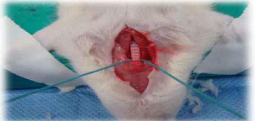 Figura 5 - Reparo traqueal com fio de poliéster trançado 1. 