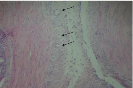 Fig.  5  Fotomicrografia  da  aspecto  histológico  da  angiogênese  leve (seta) na submucosa do cólon obstruído de ratos tratados ou  não com o sildenafil (aumento de 200 x) 