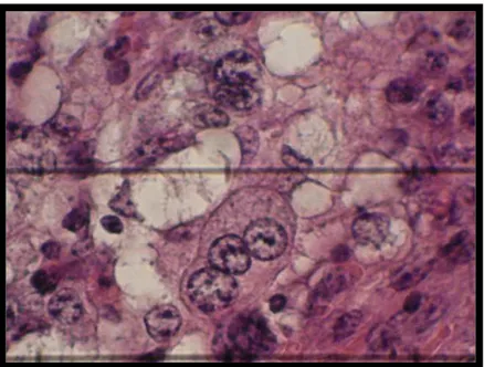 Figura  9:  célula  trinucleada do  placentomo  da  vaca  corte  histológico  corado  por  Hematoxilina-eosina  no  terço  final  da  gestação,  aumento  de 40x