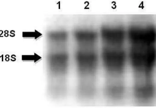 Figura  4:  Eletroforese  em  gel  de  agarose/formaldeído  de  RNA  total  extraído  de  folhas  de  C
