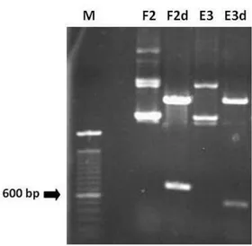 Figura 6: Eletroforese de DNA plasmidial pCR 2.1 dos possíveis clones de CMS2MS2, F2 e E3