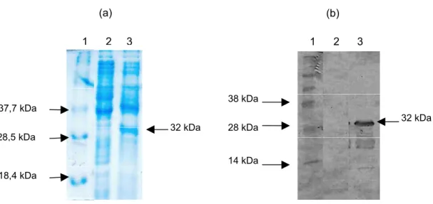 Figura 5 – Expressão do gene etx de Clostridium perfringens tipo D no sistema pET-11a.