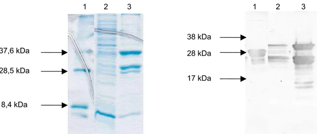 Figura 7 – Expressão do gene etx de Clostridium perfringens tipo D no sistema pET 11a nas formas solúvel e insolúvel, após a lise bacteriana.