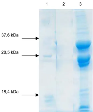 Figura 9 – Solubilização com uréia 6,0 M dos corpos de inclusão obtidos a partir da expressão do gene etx de Clostridium perfringens tipo D.
