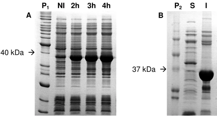 Figura 19: Expressão da proteína NahE no vetor pET28a-TEV em BL21 a 37°C, IPTG 1 mM. 