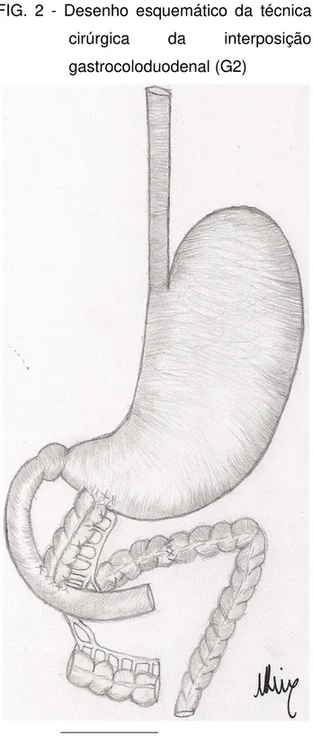 FIG.  2  -  Desenho  esquemático  da  técnica  cirúrgica  da  interposição  gastrocoloduodenal (G2) 
