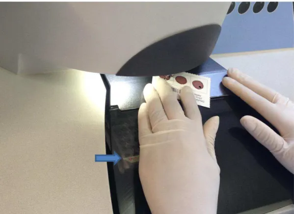 Figura  3:  Sangue  seco  em  papel  filtro  no  picotador  automático  do  Laboratório  de  Triagem  Pré-Natal  do  NUPAD-UFMG e placa de ELISA abaixo (seta)