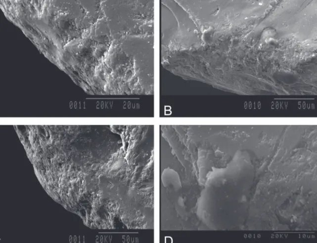 FIG. 5.1.3.1-7  – O-16 C U.E. 4 U.A. 10 A: abrasión y compactación (SEM 2000 X), B: abrasión, compactación y estrías (SEM 600 x), 